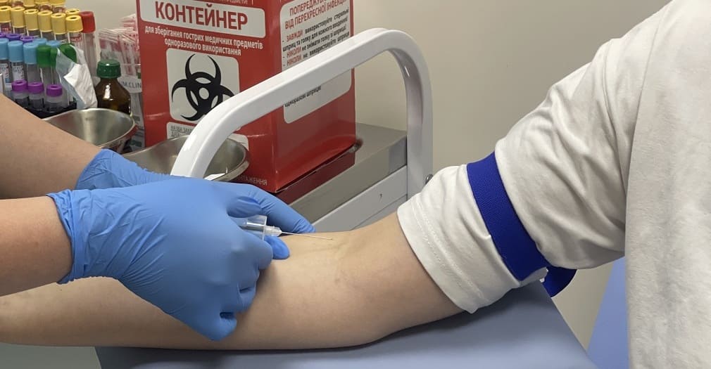 Гормональные нарушения